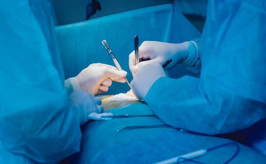 Undergo Penis Enlargement Surgery